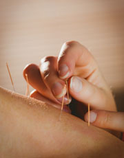 Acupunture