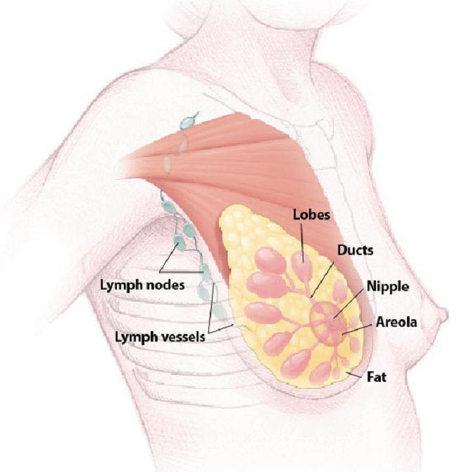 Breast Lumps: Clogged Milk Duct or Cancer?